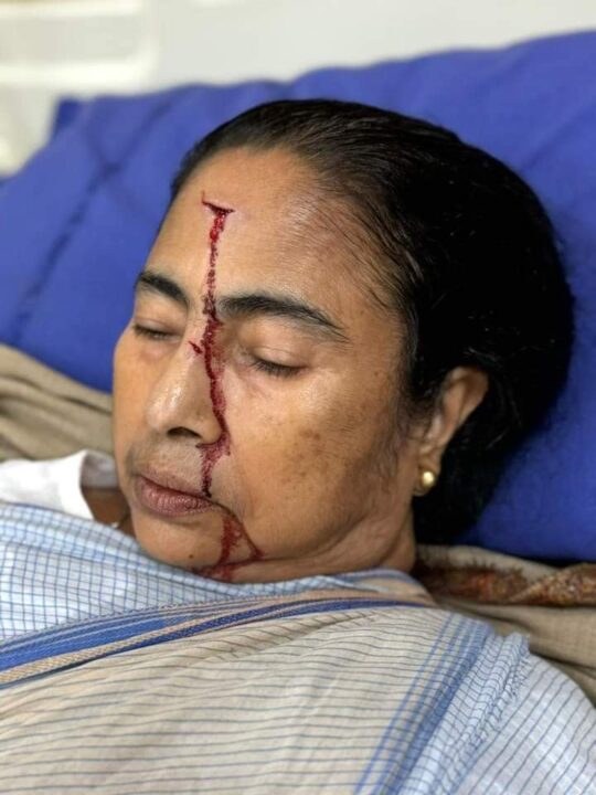 গুরুতর আহত মুখ্যমন্ত্রী, ভর্তি এসএসকেএম হাসপাতালে।